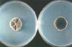 Toxigenic Mold - CLADOSPORIUM